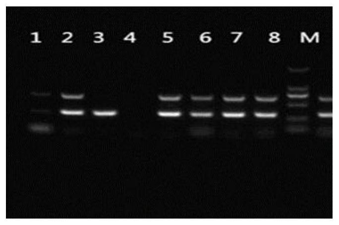 Primer group and kit for detecting drug resistance genes of streptococcus suis based on multiple PCR-DHPLC and application of primer group and kit