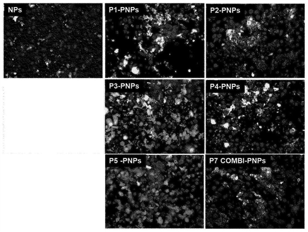 Composition for lipolysis using surface-modified gas-generating nanoparticles