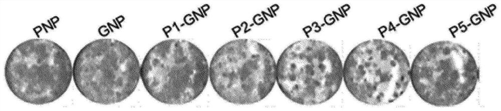 Composition for lipolysis using surface-modified gas-generating nanoparticles