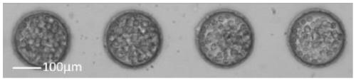 Micro-fluidic chip and drug administration culture method for tumor cell three-dimensional culture