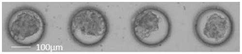 Micro-fluidic chip and drug administration culture method for tumor cell three-dimensional culture