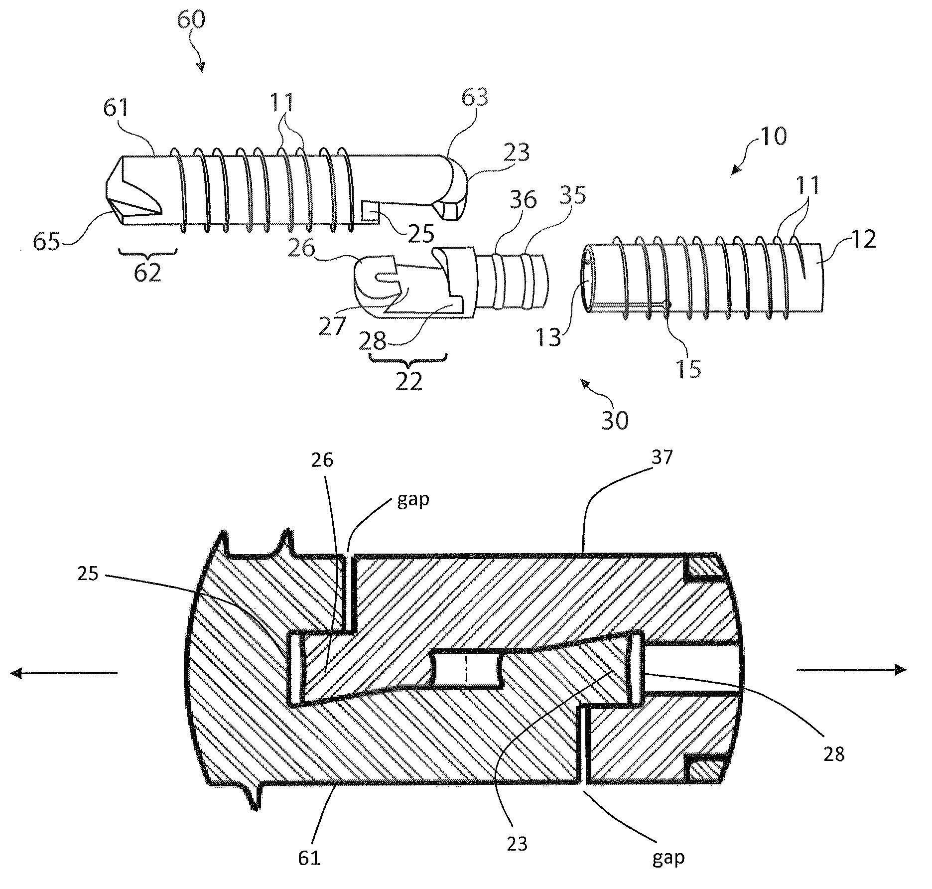 Distal interphalangeal fusion method and device