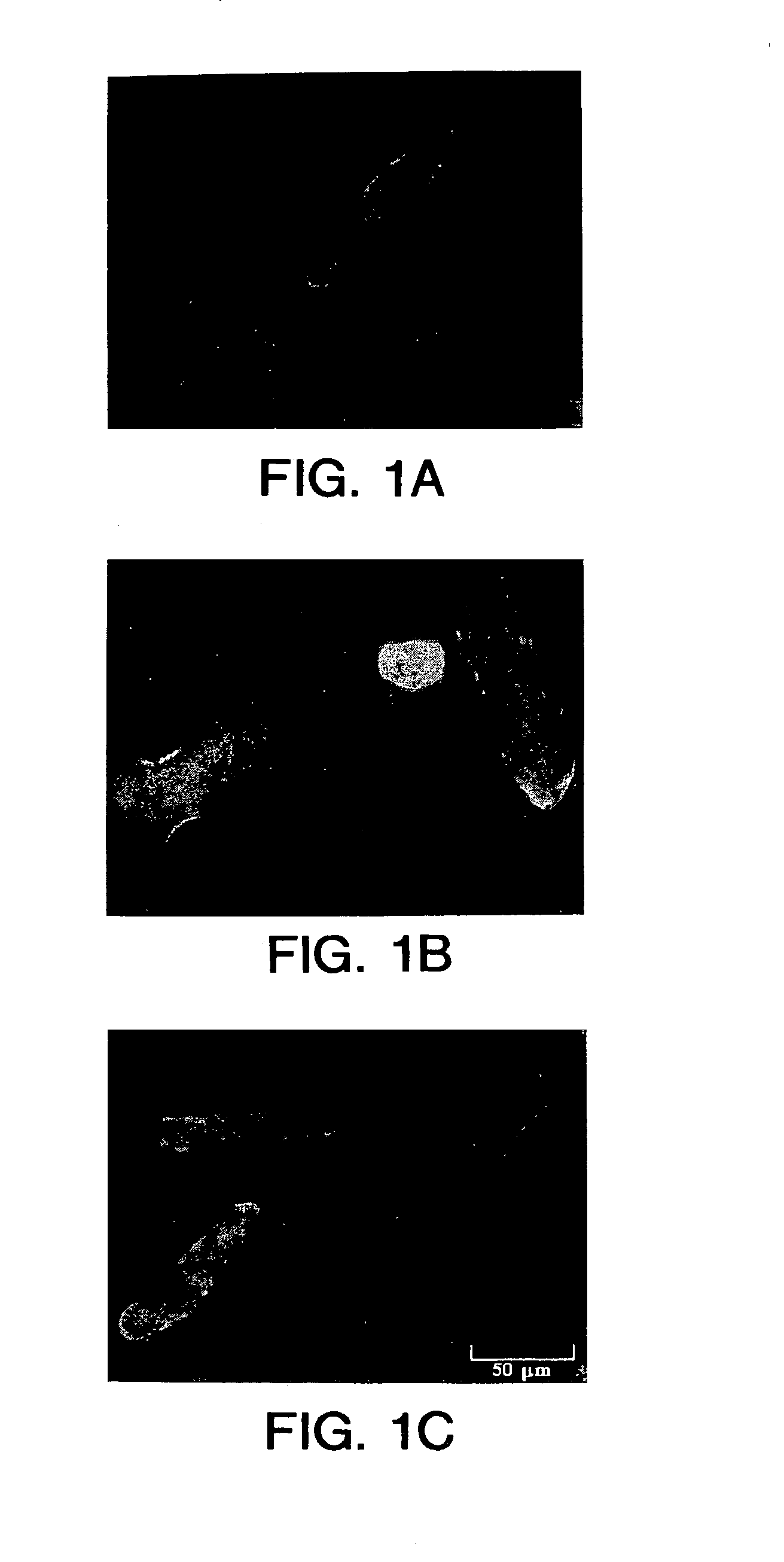 Methods for treating cardiac hypertrophy by administering IFN-γ