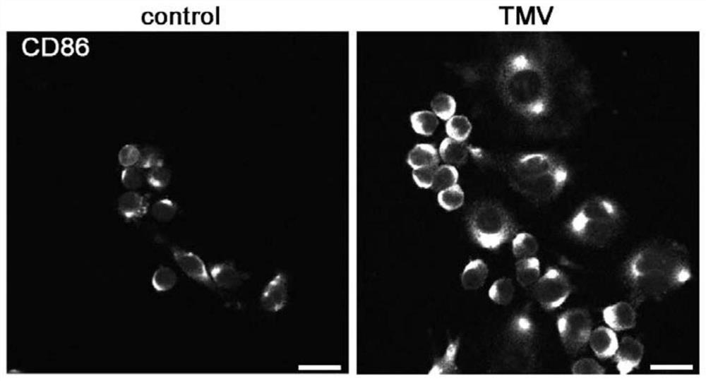 Application of tobacco mosaic virus in stimulation of polarization of macrophages into M1 type macrophages