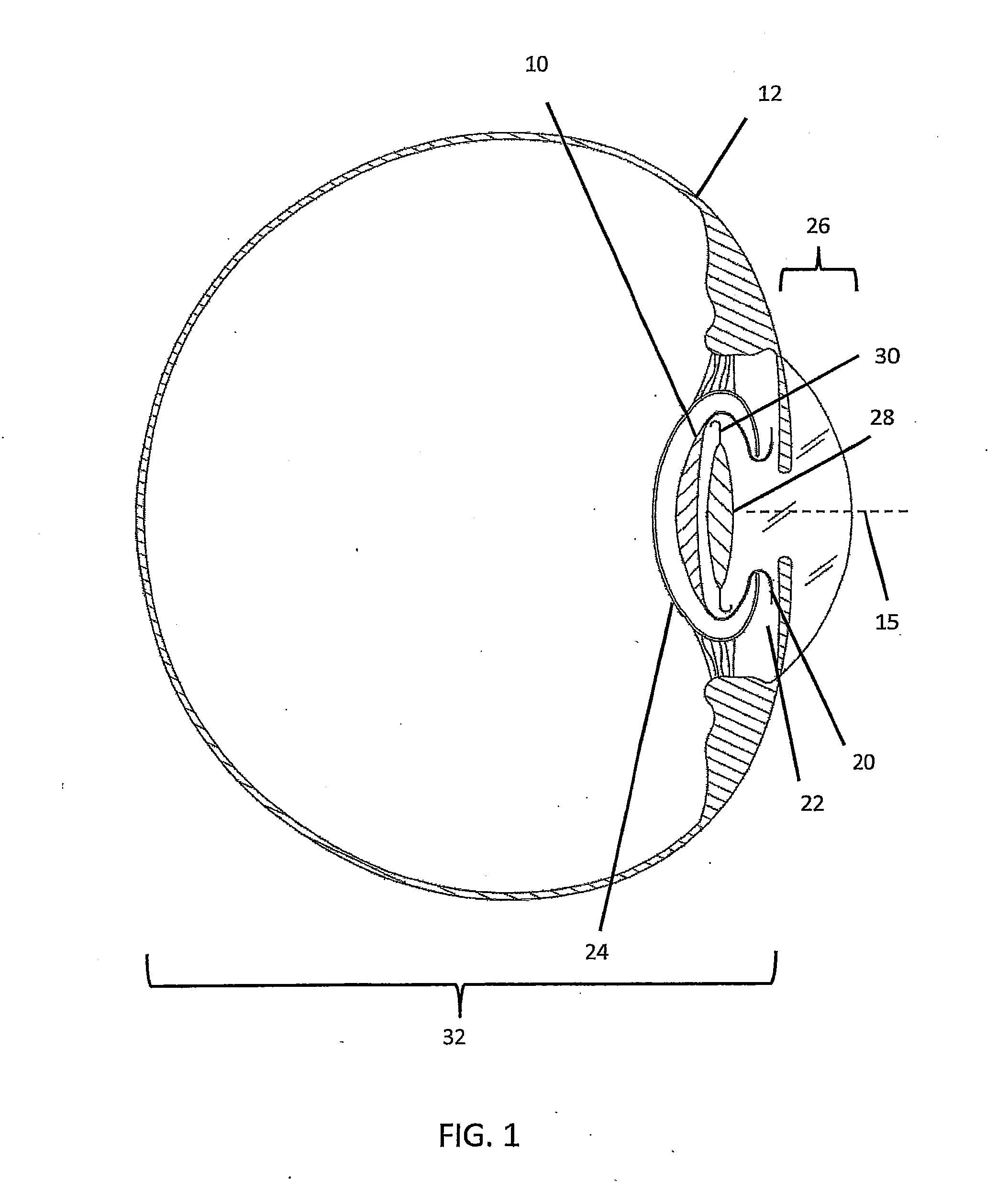 Prosthethic capsular bag and method of inserting the same