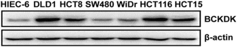 Applications of BCKDK as biomarker in preparation of tumor diagnosis kits