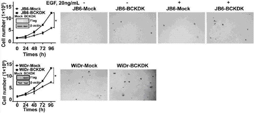 Applications of BCKDK as biomarker in preparation of tumor diagnosis kits