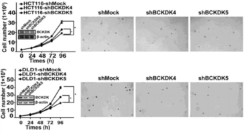 Applications of BCKDK as biomarker in preparation of tumor diagnosis kits