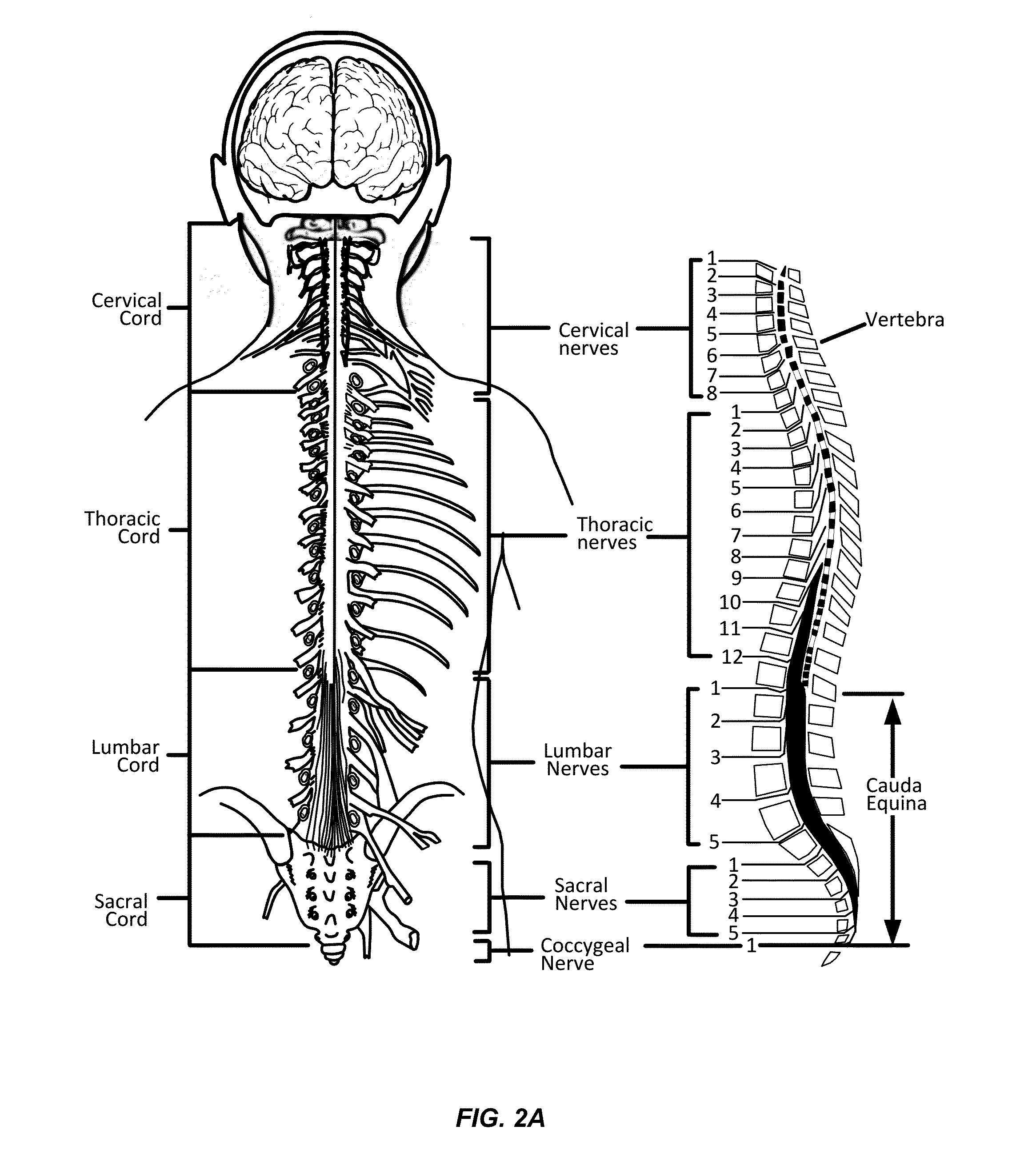 Integrated Electromyographic Clinician Programmer for Use with an Implantable Neurostimulator