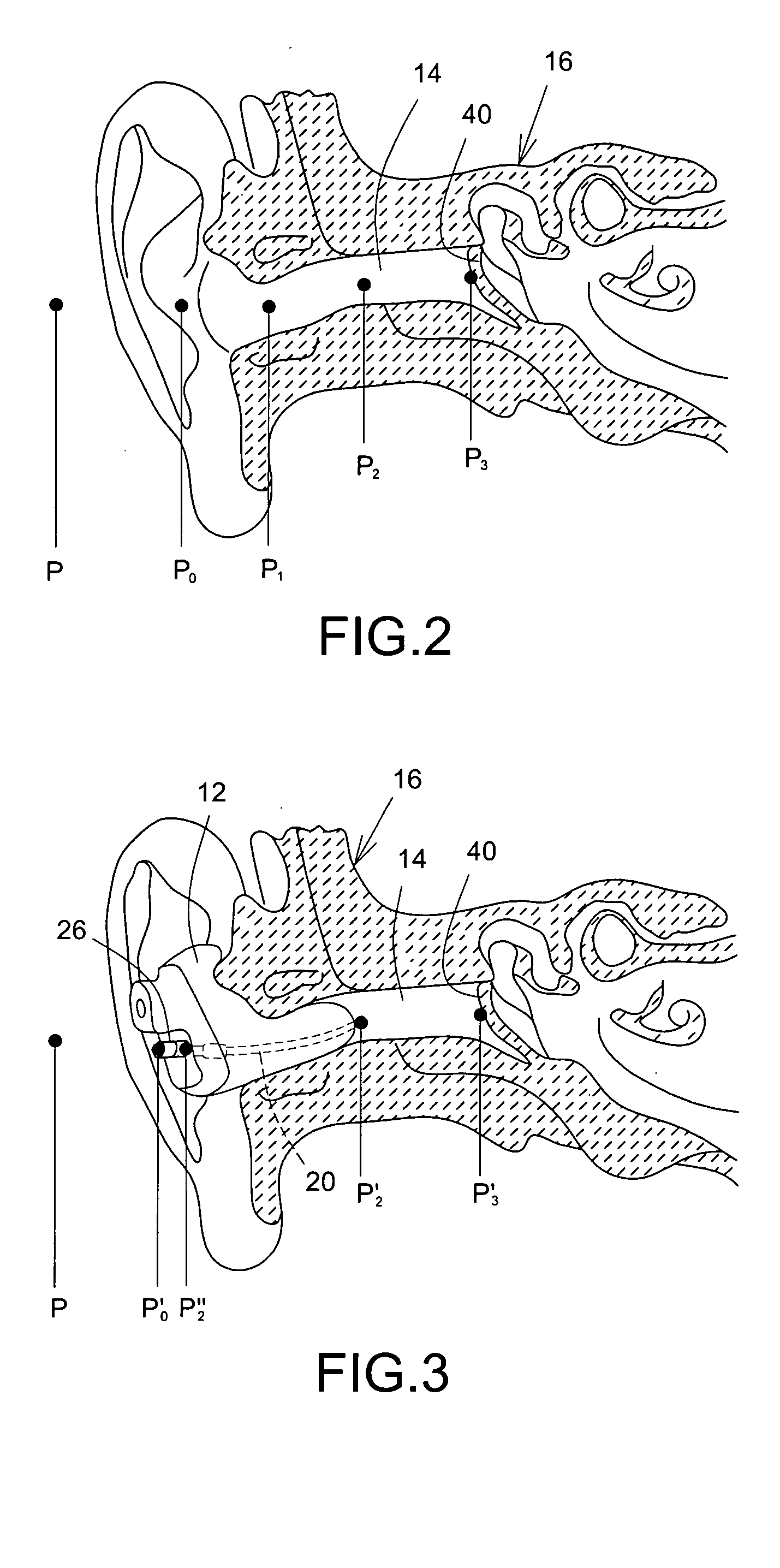 Method and apparatus for objective assessment of in-ear device acoustical performance