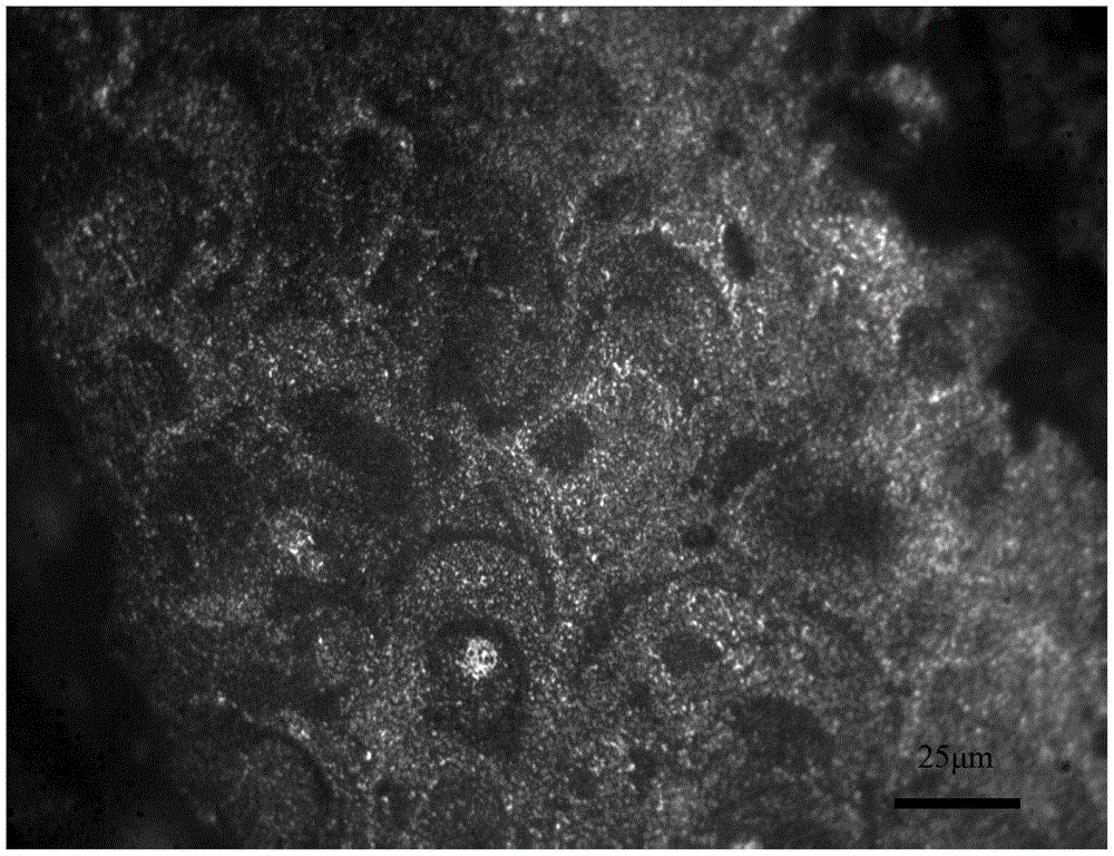 Method for obtaining hard particle coatings by laser-assisted cold spraying on hard substrates