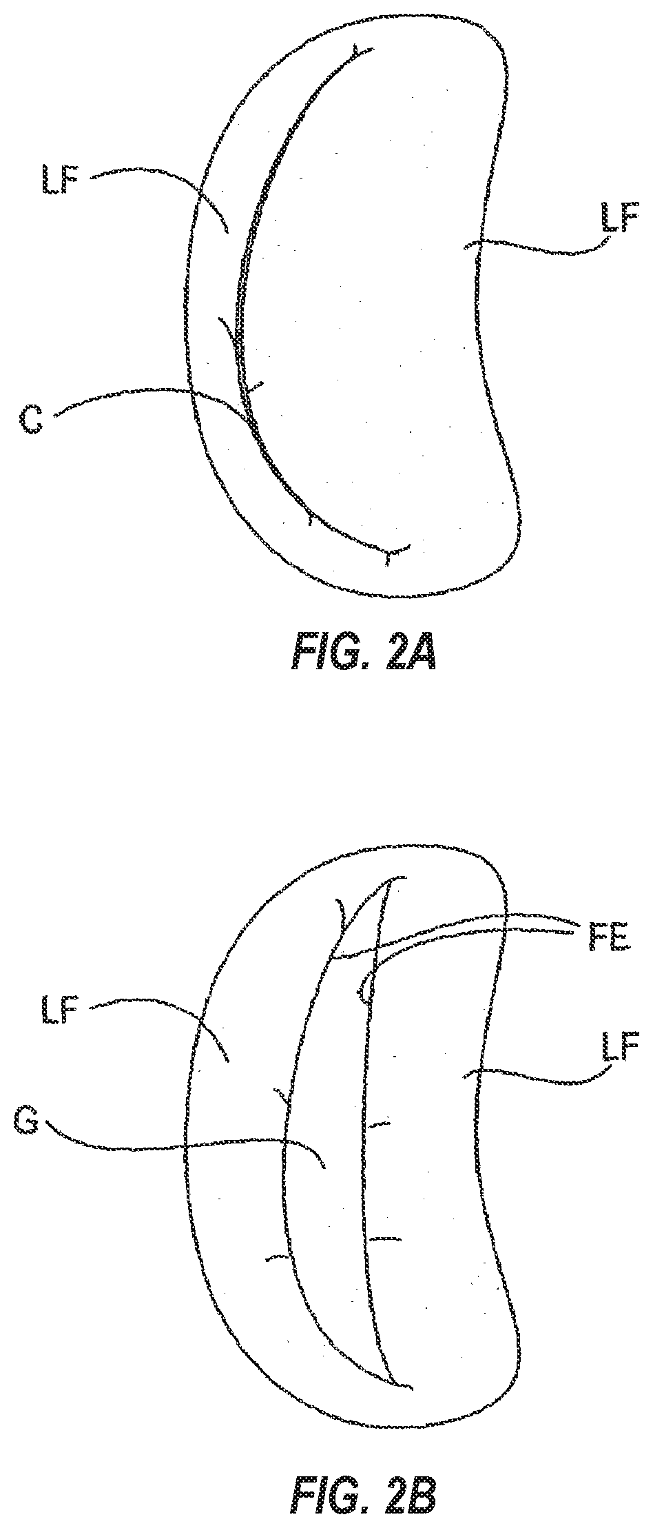 Tissue cutting systems, devices and methods