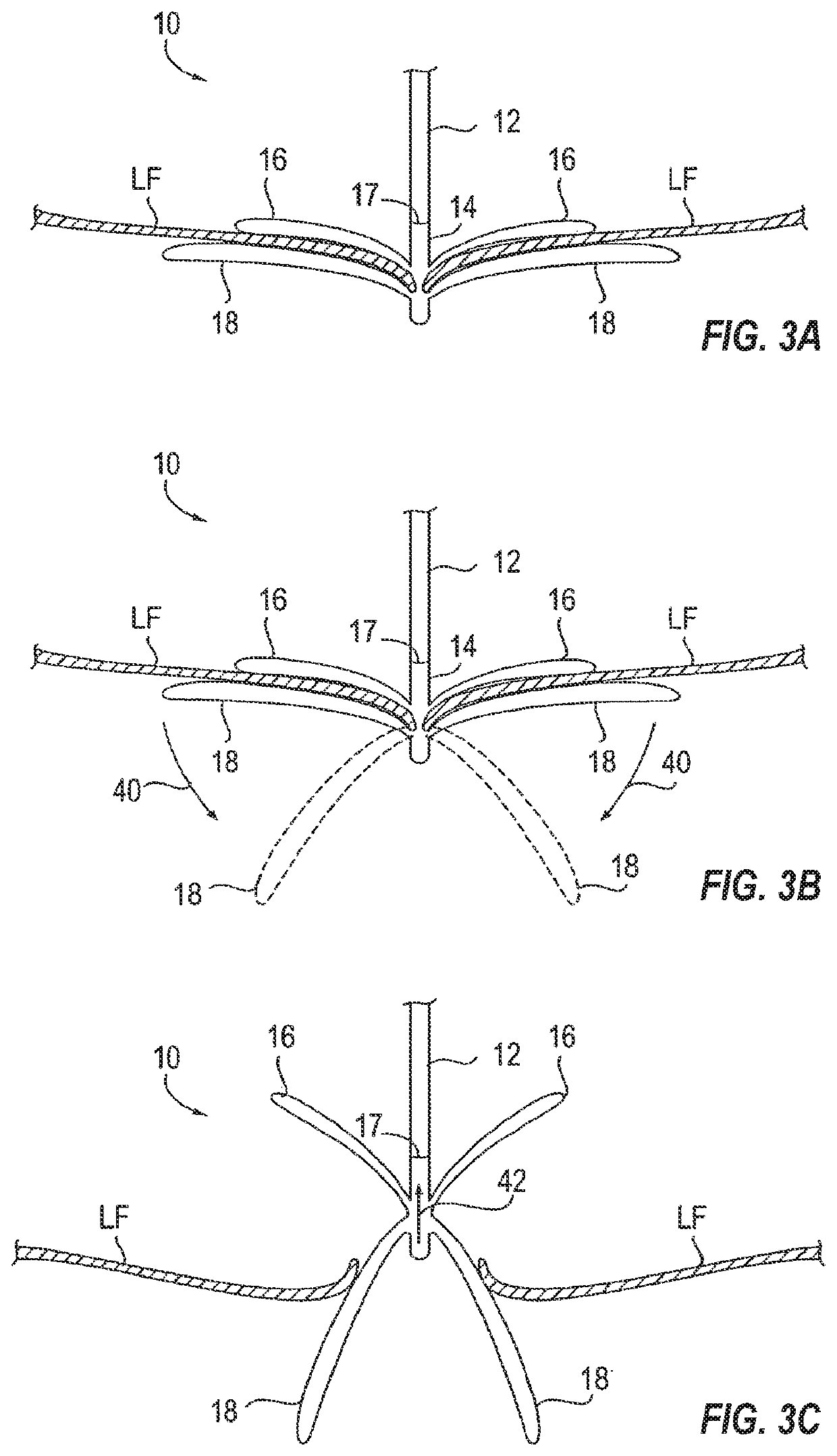Tissue cutting systems, devices and methods