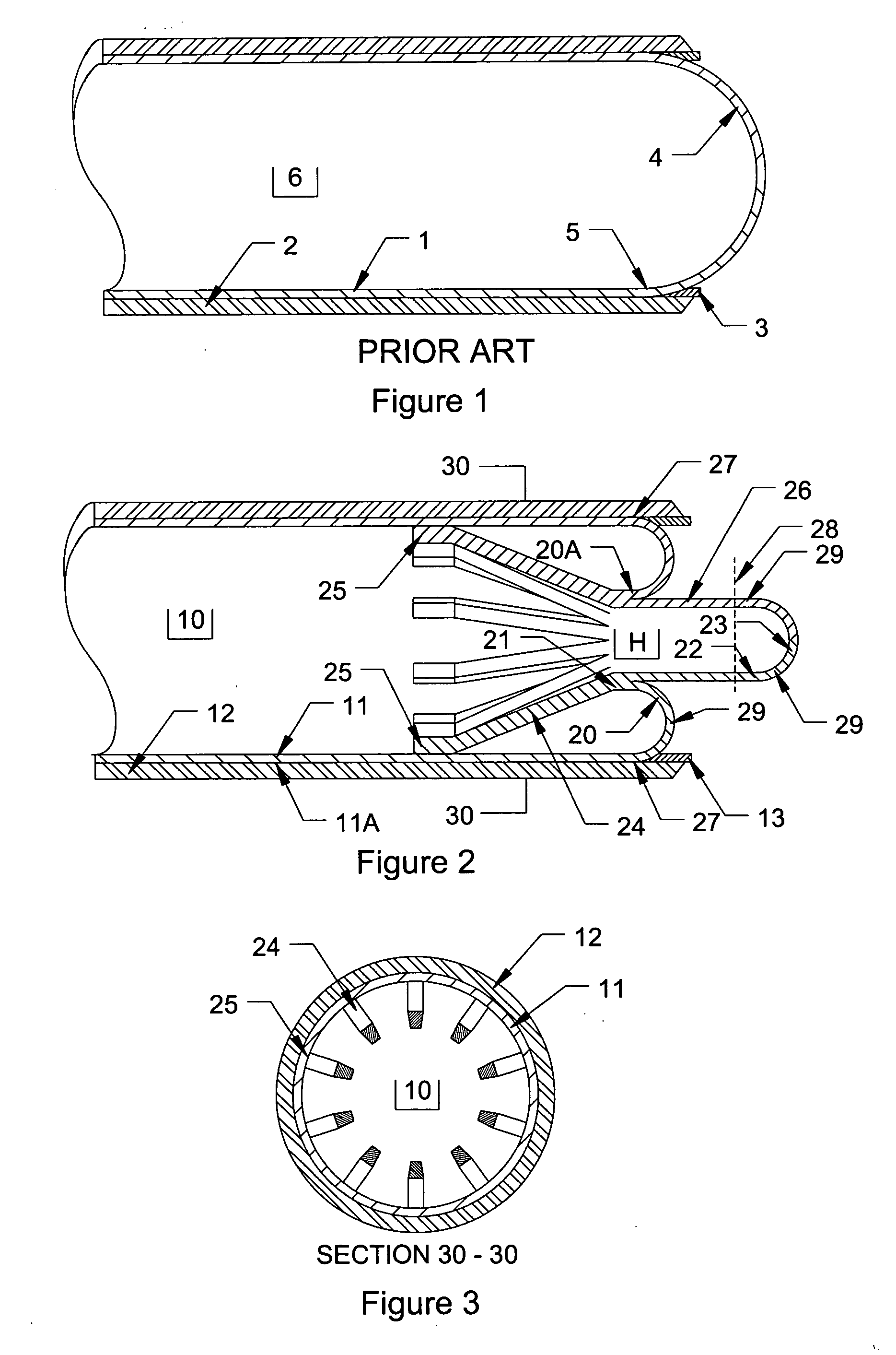 End fitting for pressure vessel