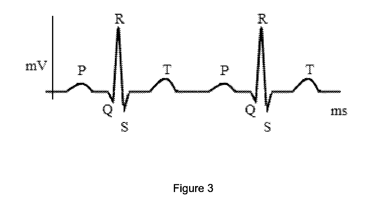 A method for obtaining the blood pressure of a person, and a device thereof