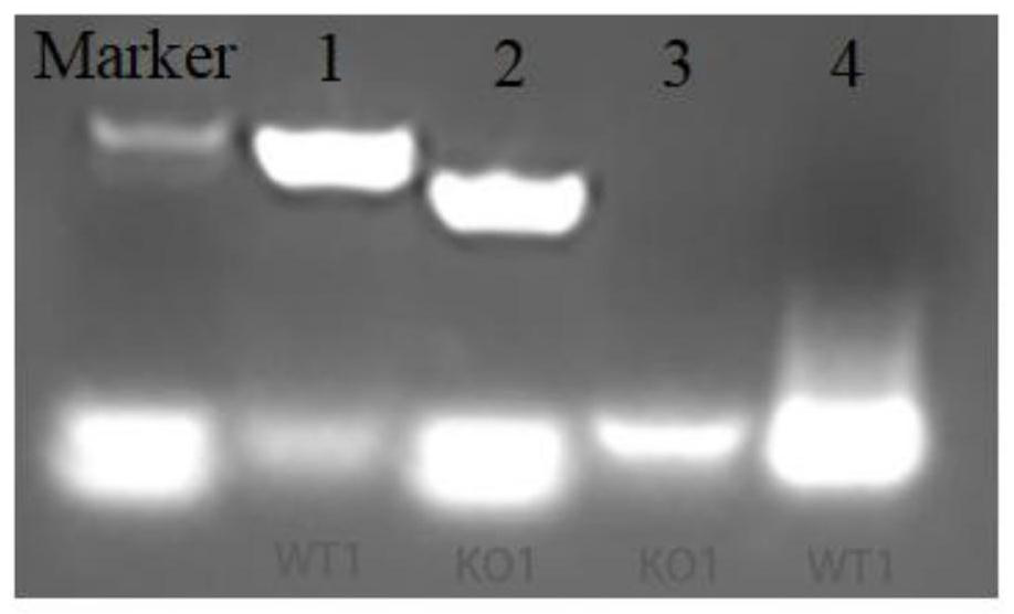 Application of P2Y12 receptor and antagonist thereof in diagnosis and treatment of acute pancreatitis