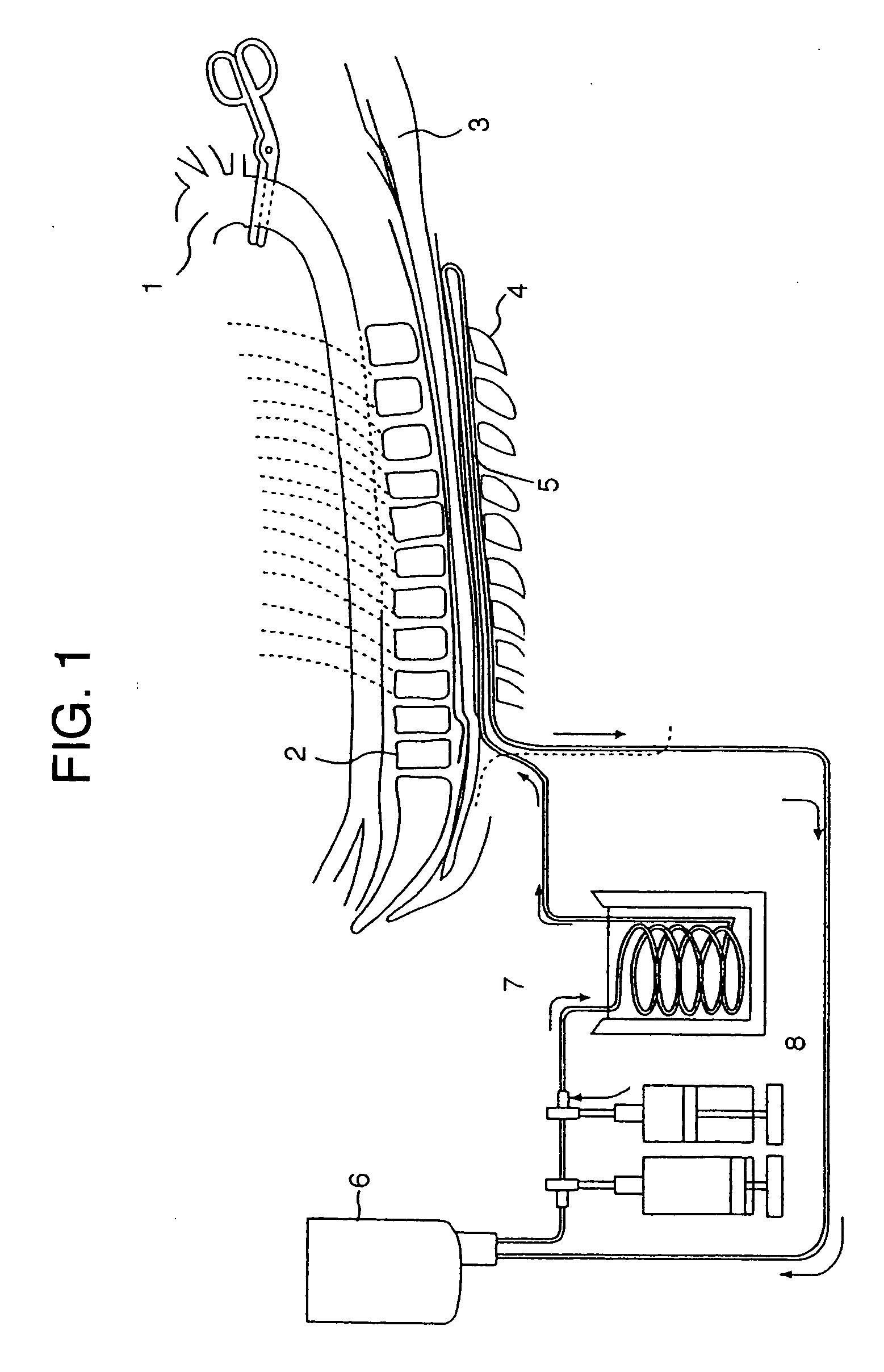 Catheter for topical cooling and topical cooling device using the same