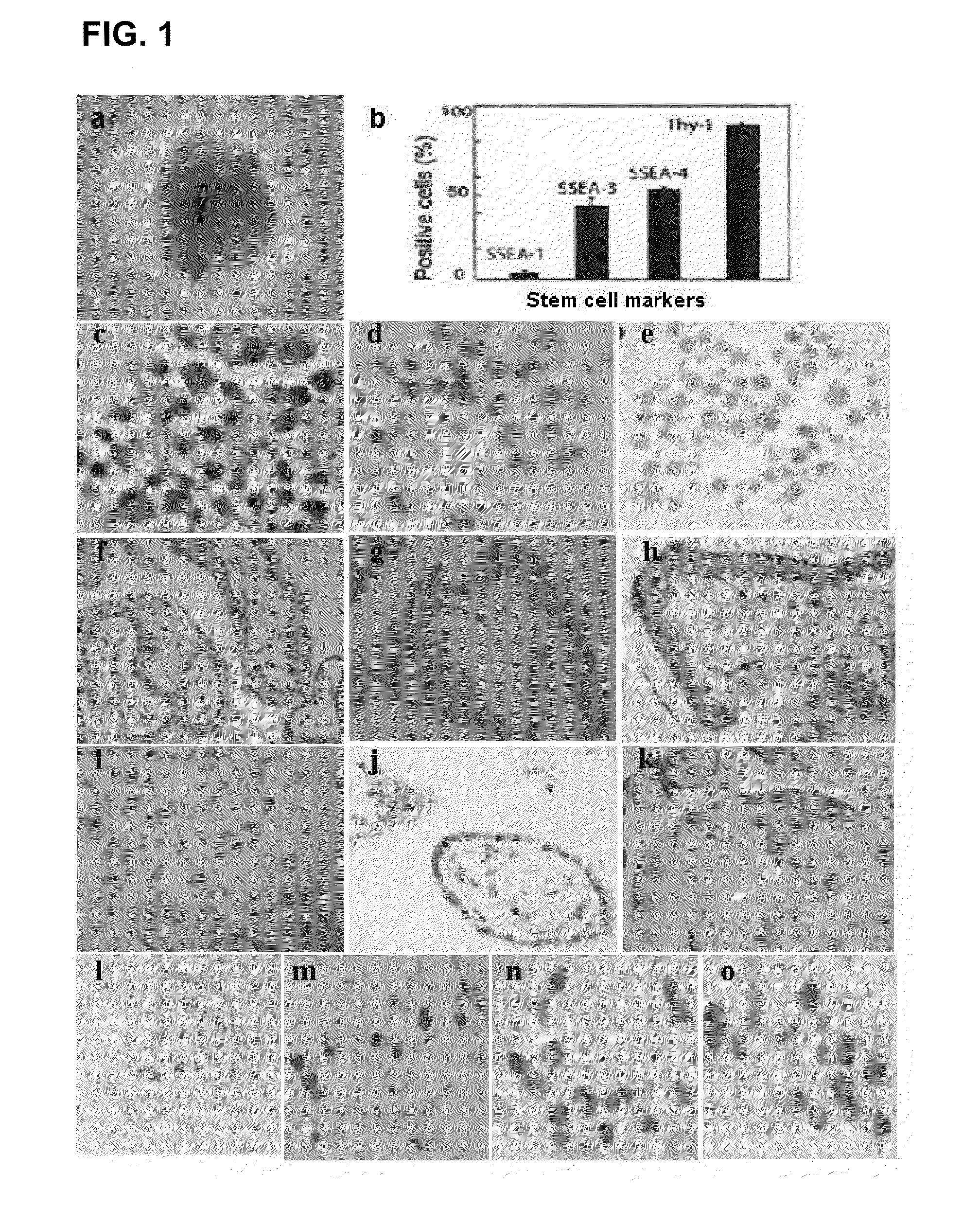 Human trophoblast stem cells and use thereof