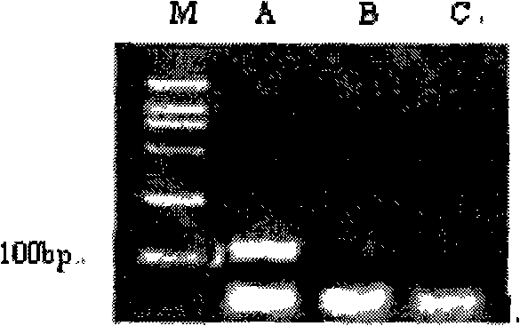 Primer for quantitative and qualitative determination of blue tongue virus