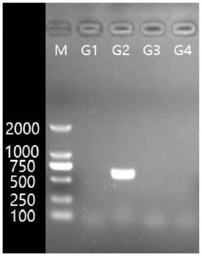 Serotyping method of Actinobacillus pleuropneumoniae, primer set and PCR (polymerase chain reaction) systems