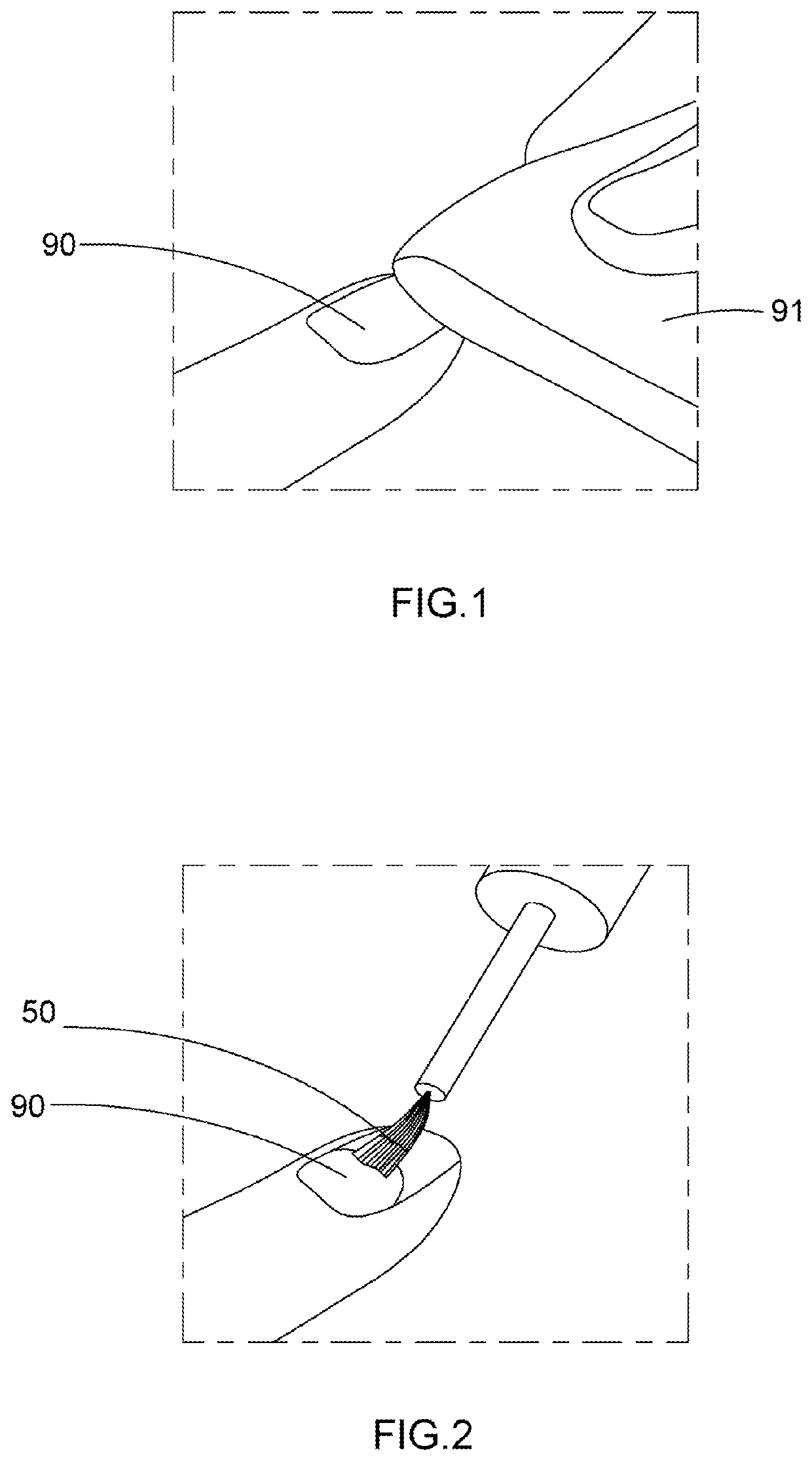 Artificial nail tip and curing composition set and applying method thereof