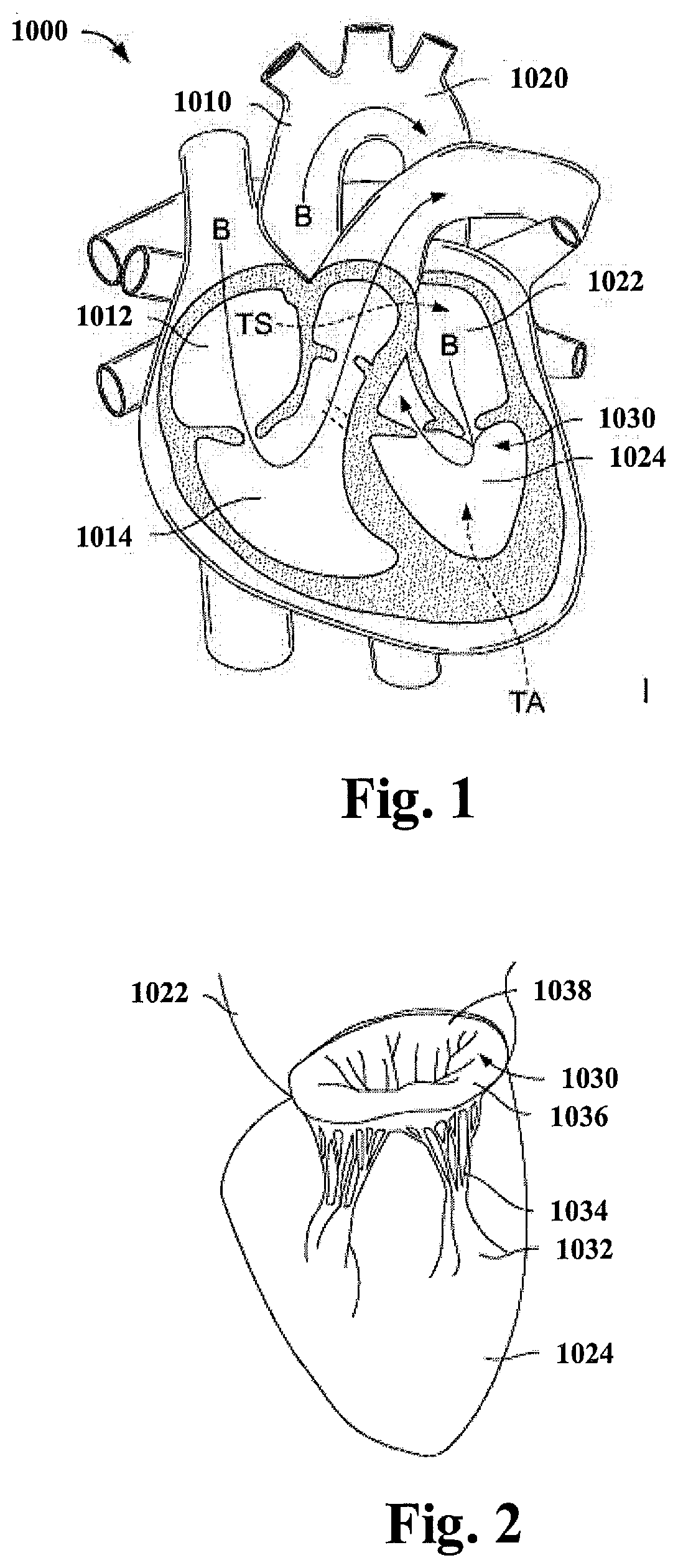 Tethering System For A Prosthetic Heart Valve