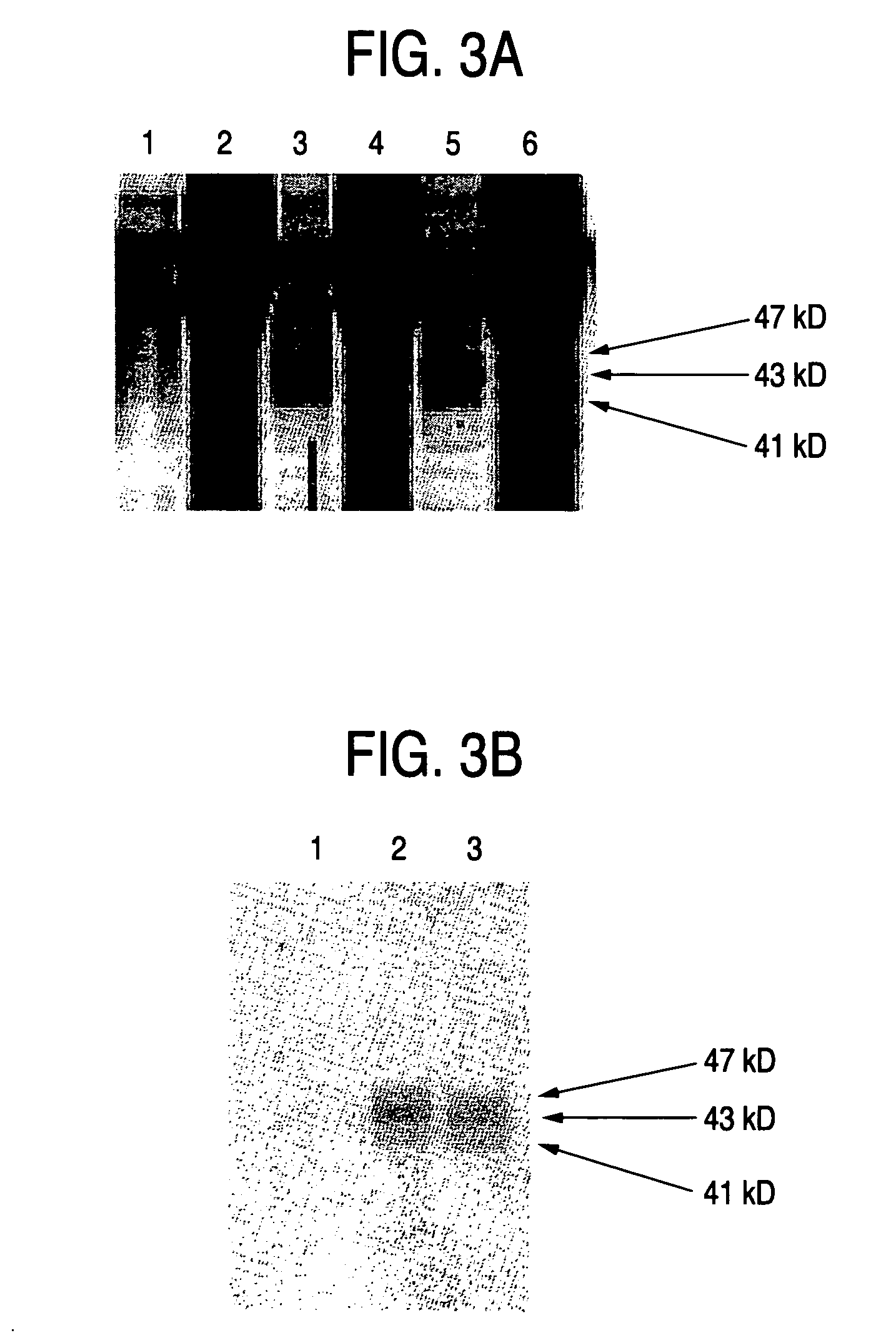 Process for producing sugar chains using beta1,3-N-acetylglucosaminyltransferase