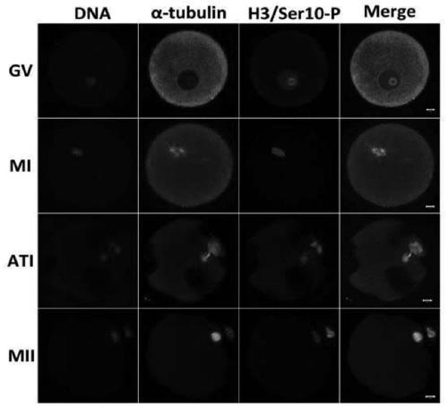 Application of human histone h3 Ser10 and Ser28 in identification of human oocyte maturation stage