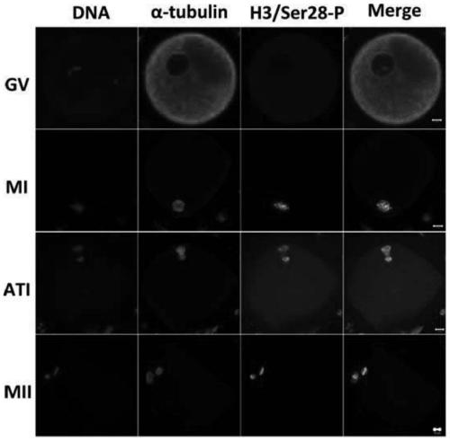 Application of human histone h3 Ser10 and Ser28 in identification of human oocyte maturation stage