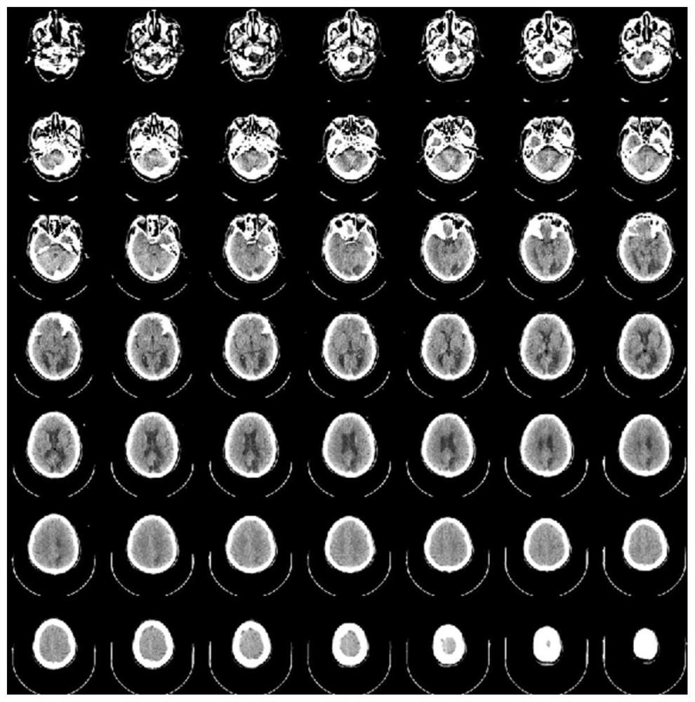 Brain image-based infarction region segmentation method and device, equipment and medium