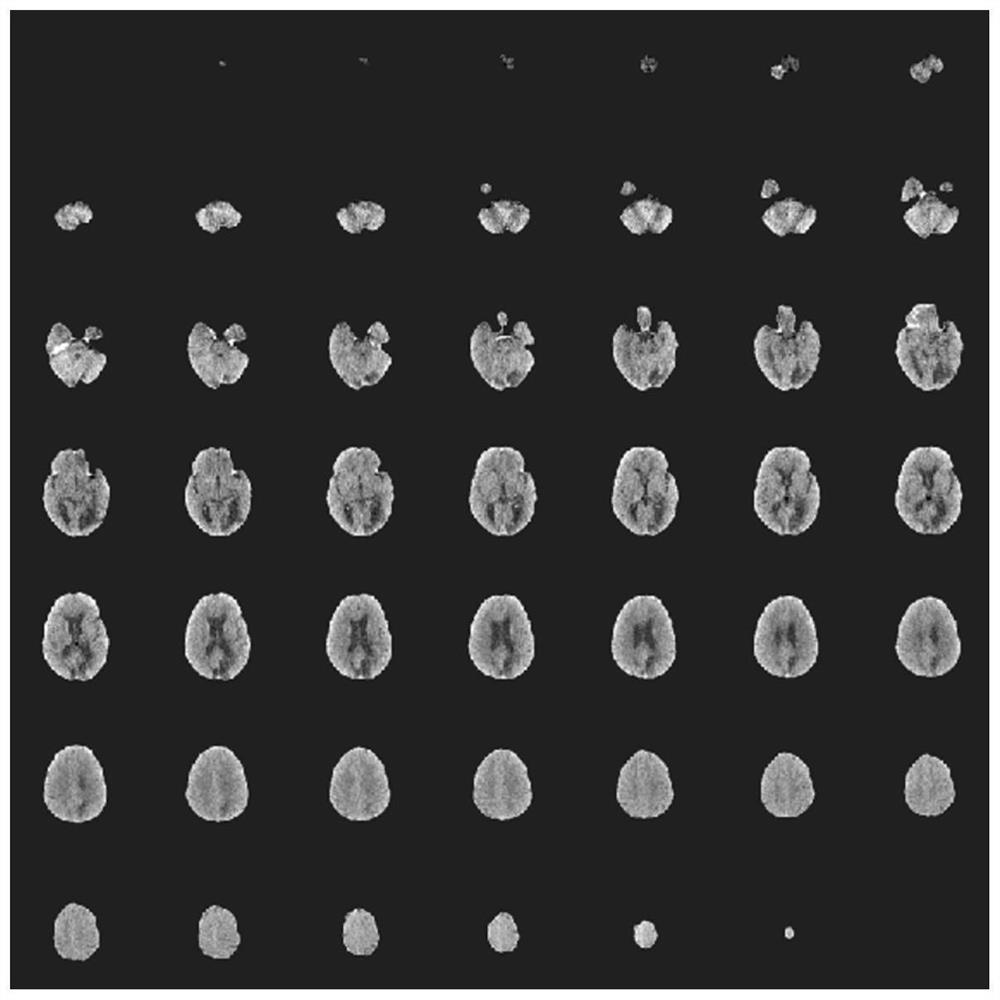 Brain image-based infarction region segmentation method and device, equipment and medium