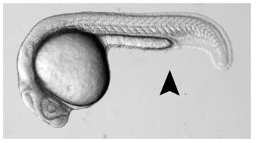 Down's Syndrome Therapeutic Composition and Its Application