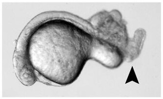 Down's Syndrome Therapeutic Composition and Its Application