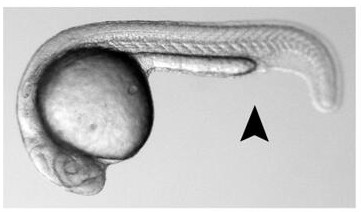 Down's Syndrome Therapeutic Composition and Its Application