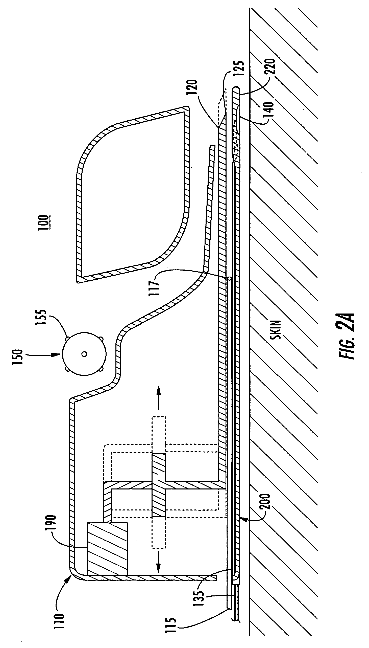 Devices and systems for separating and preparing skin
