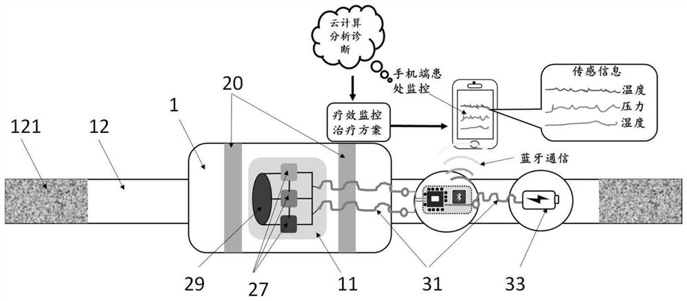 A wearable real-time monitoring device for bruise treatment