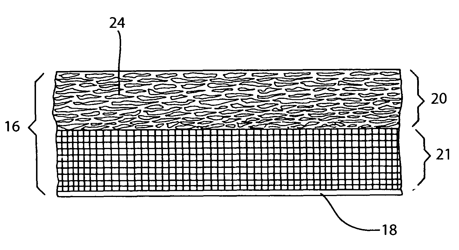 Atomic layer epitaxy processed insulation