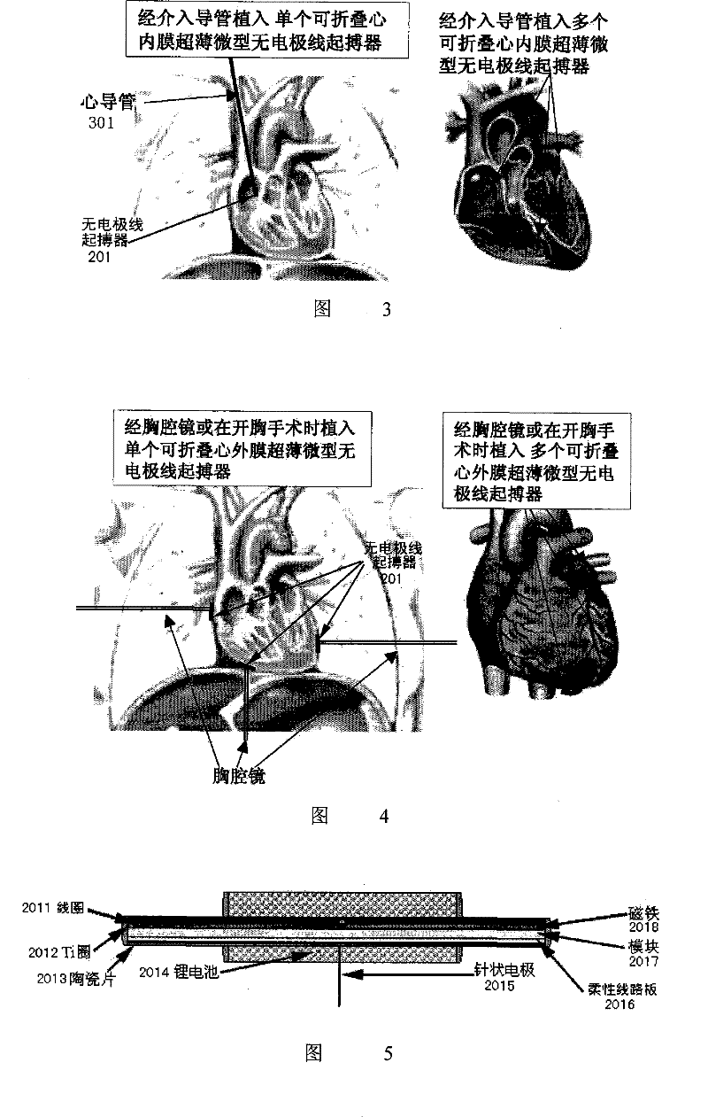 No-electrode ultrathin minitype multifunctional heart rhythm regulation and control device