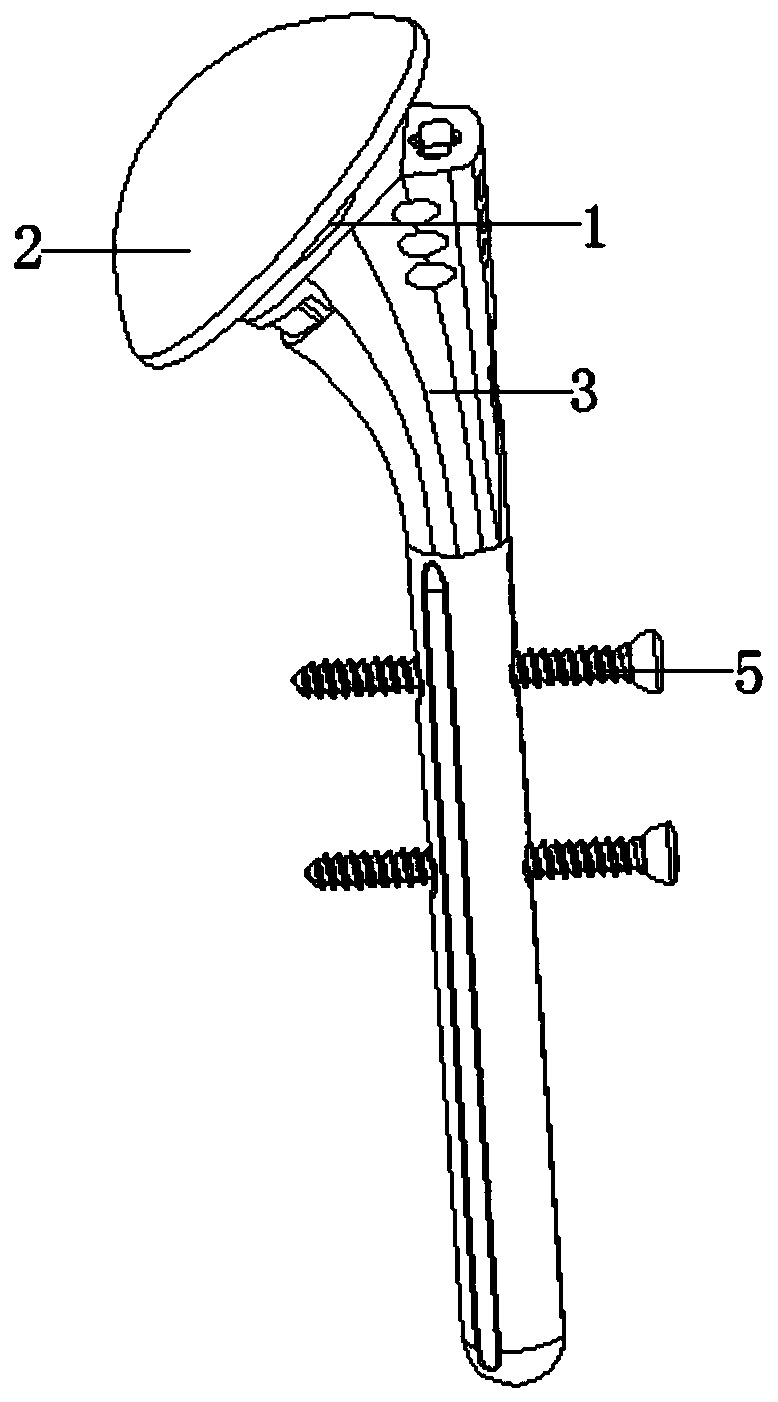 Proximal humerus head-preserving and prosthesis conversion treatment device