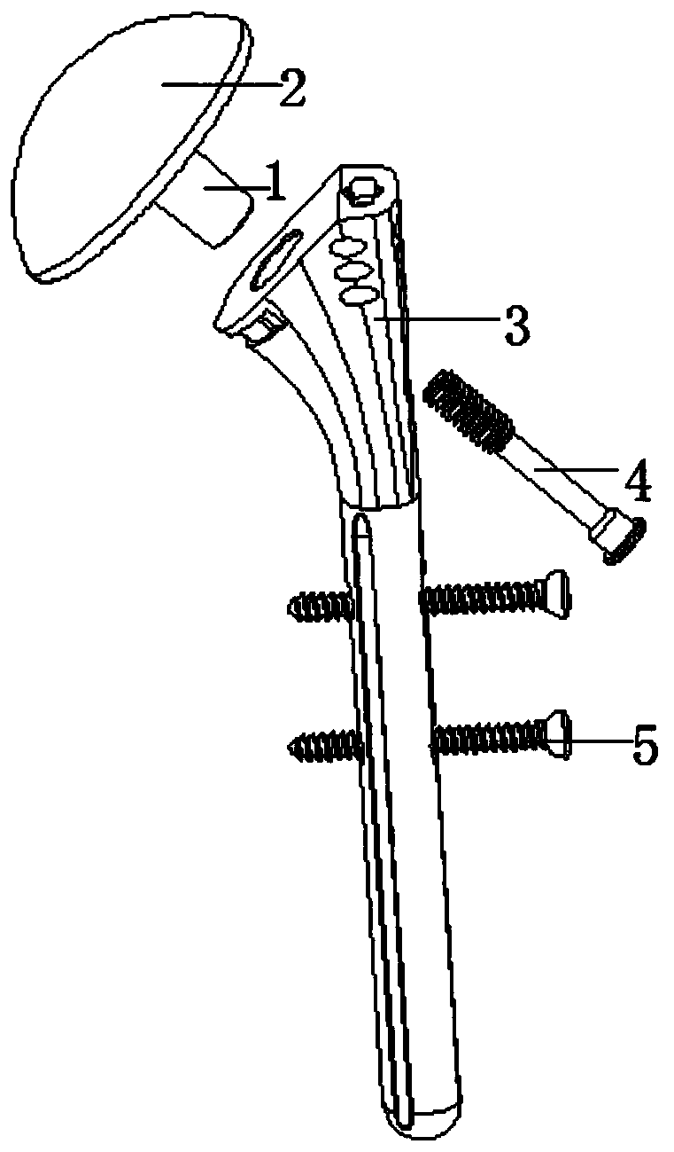 Proximal humerus head-preserving and prosthesis conversion treatment device