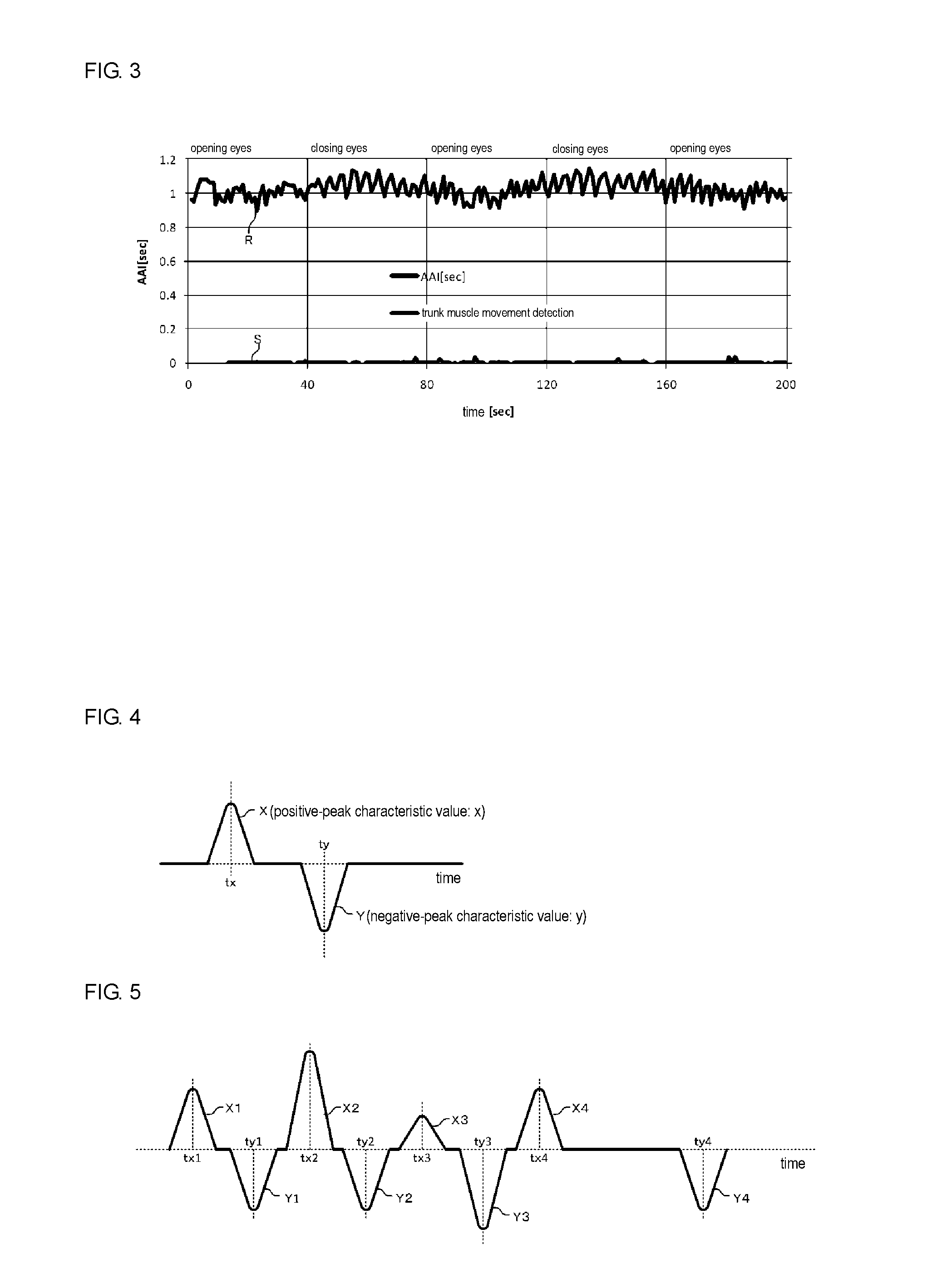 Trunk muscle contraction detection apparatus