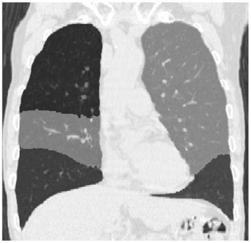 Lung lobe segmentation method and system based on three-dimensional convolutional neural network