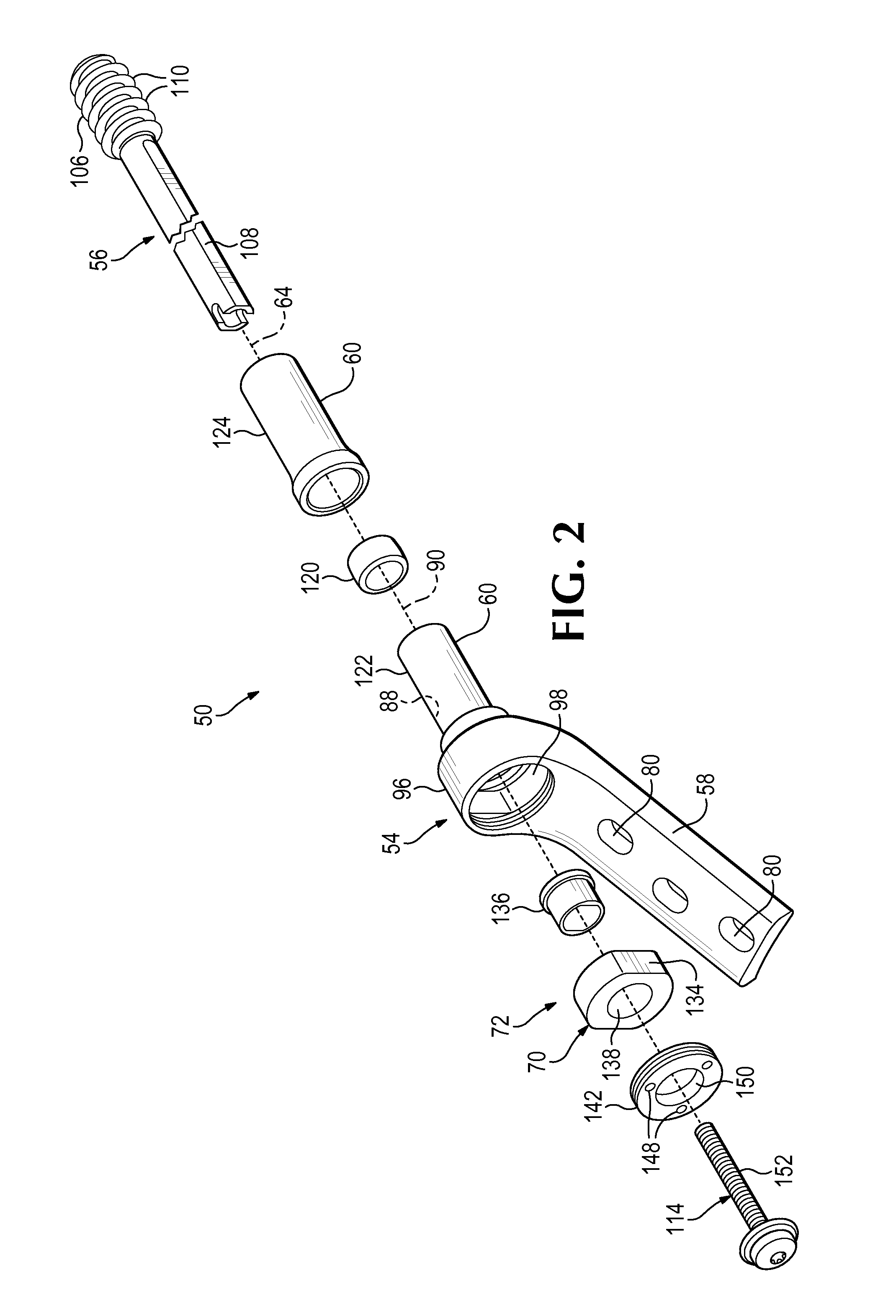 Plate-based compliant hip fixation system