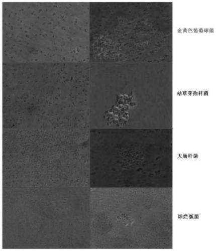 A sea cucumber-like peptidoglycan recognition protein with bactericidal activity and its preparation method and application