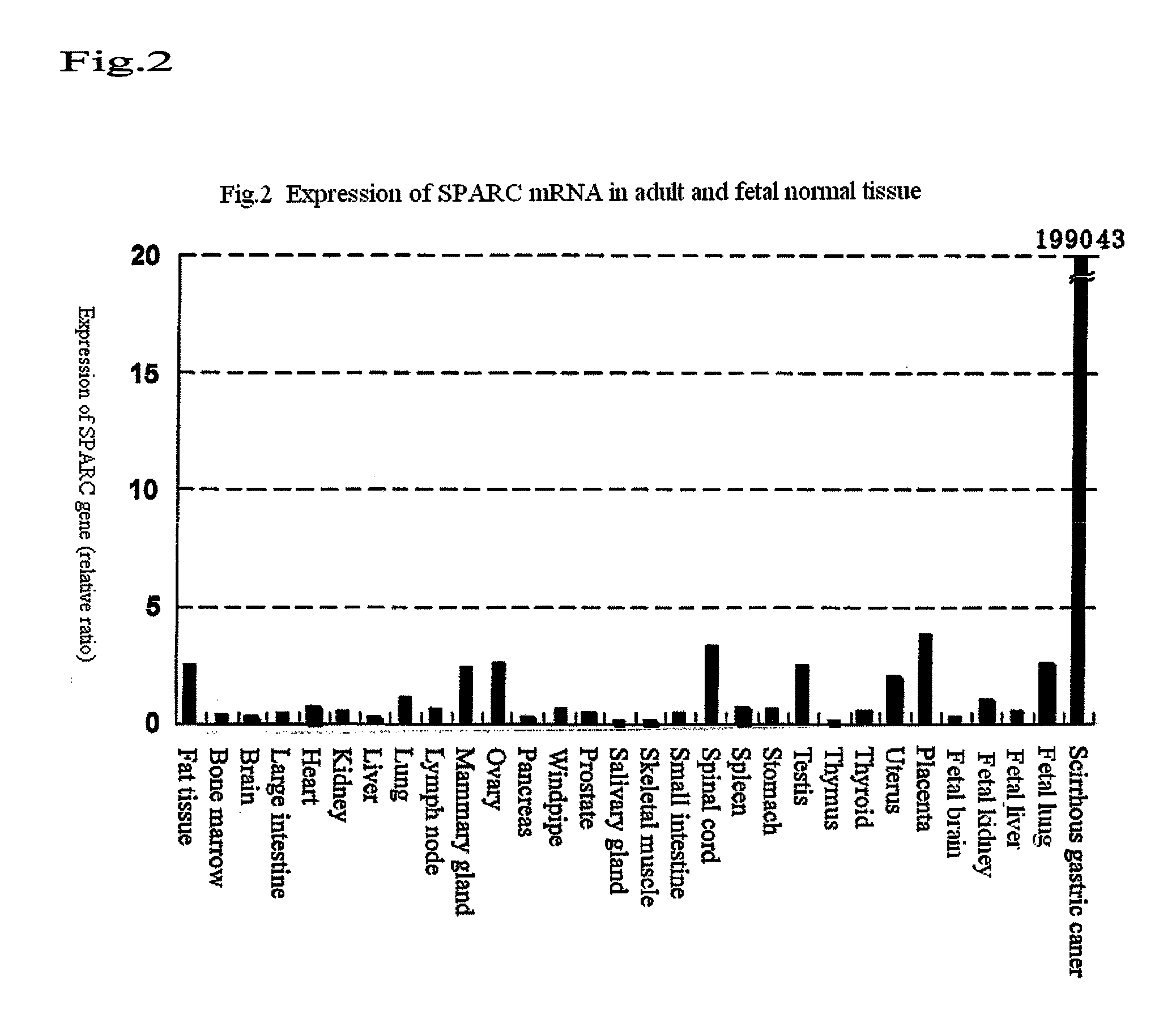 SPARC-derived tumor rejection antigenic peptides and medicaments comprising the same