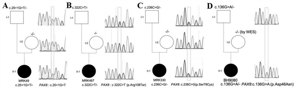 Gene mutation combination serving as marker of MRKH syndrome and application of gene mutation combination