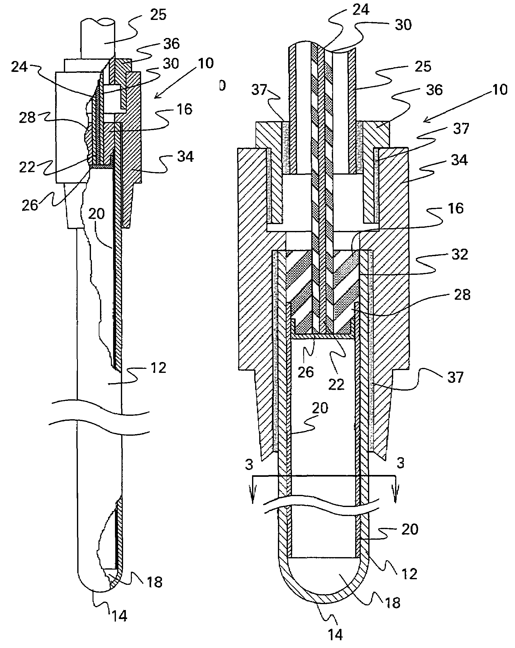 Capacitive electrostatic process for inhibiting the formation of biofilm deposits in membrane-separation systems