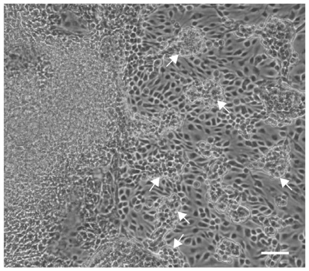 Culture medium and method for inducing pluripotent stem cells to differentiate into hematopoietic precursor cells
