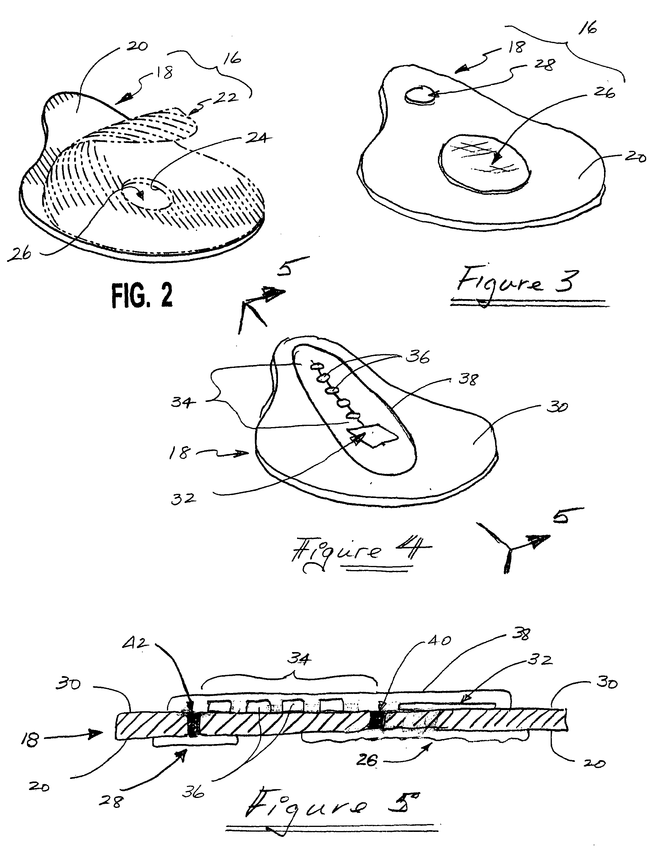 Active iontophoresis delivery system