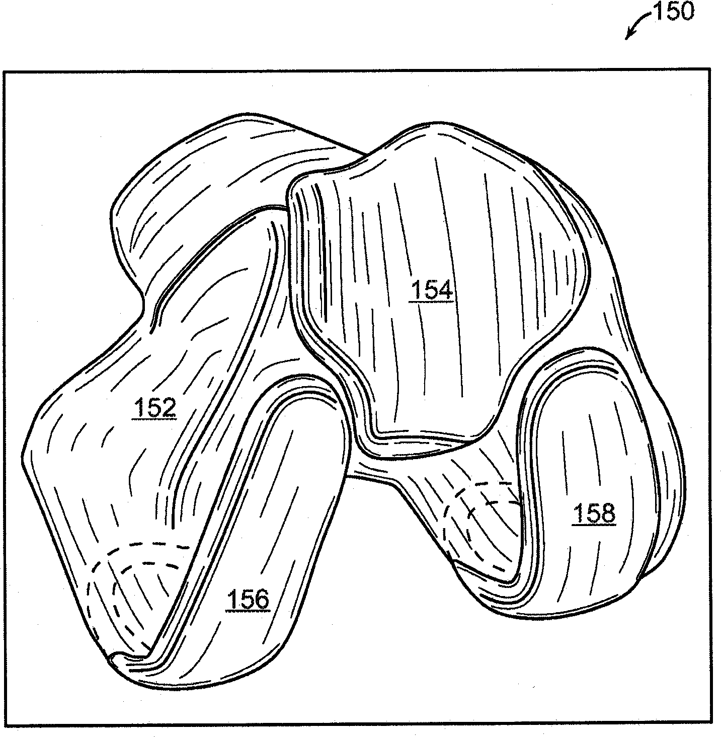 Implant Planning Using Areas Representing Cartilage